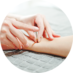 不妊と鍼灸治療